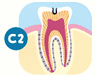 第2段階(C2)