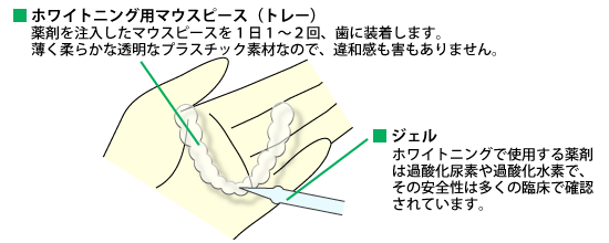 ホワイトニング手順